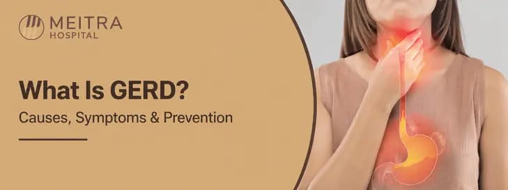 What Is GERD? 1