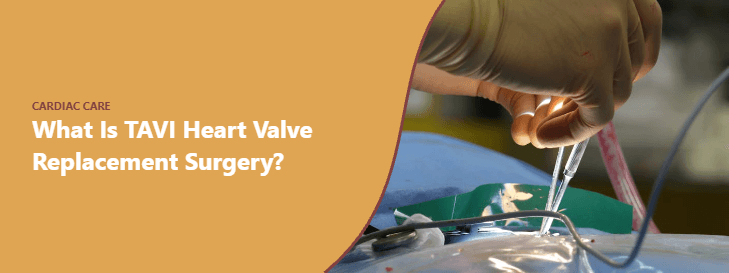 What Is TAVI Heart Valve Replacement Surgery?